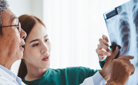 Blog global TB report thumbnail