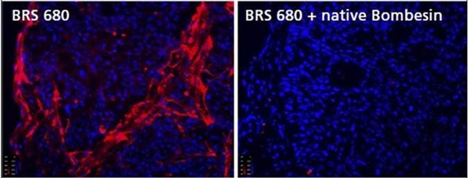 bombesin-receptor-fluorescent-probe-fig5