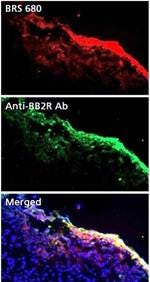 bombesin-receptor-fluorescent-probe-fig6