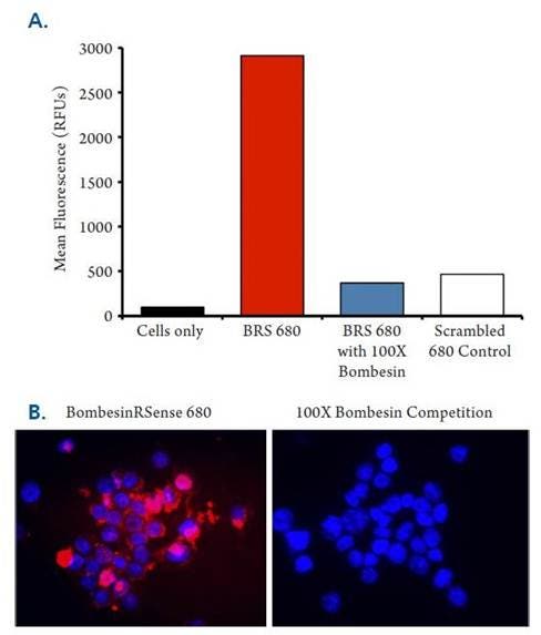 bombesin-receptor-fluorescent-probe-fig7