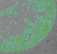 Bright field confluence wound healing