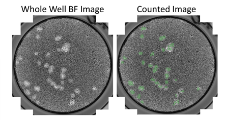 Bright field images plaque counting