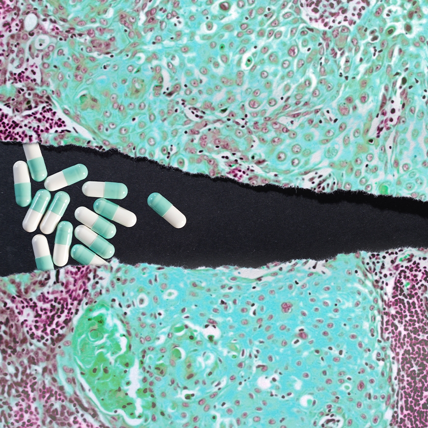 Cancer Research Solutions