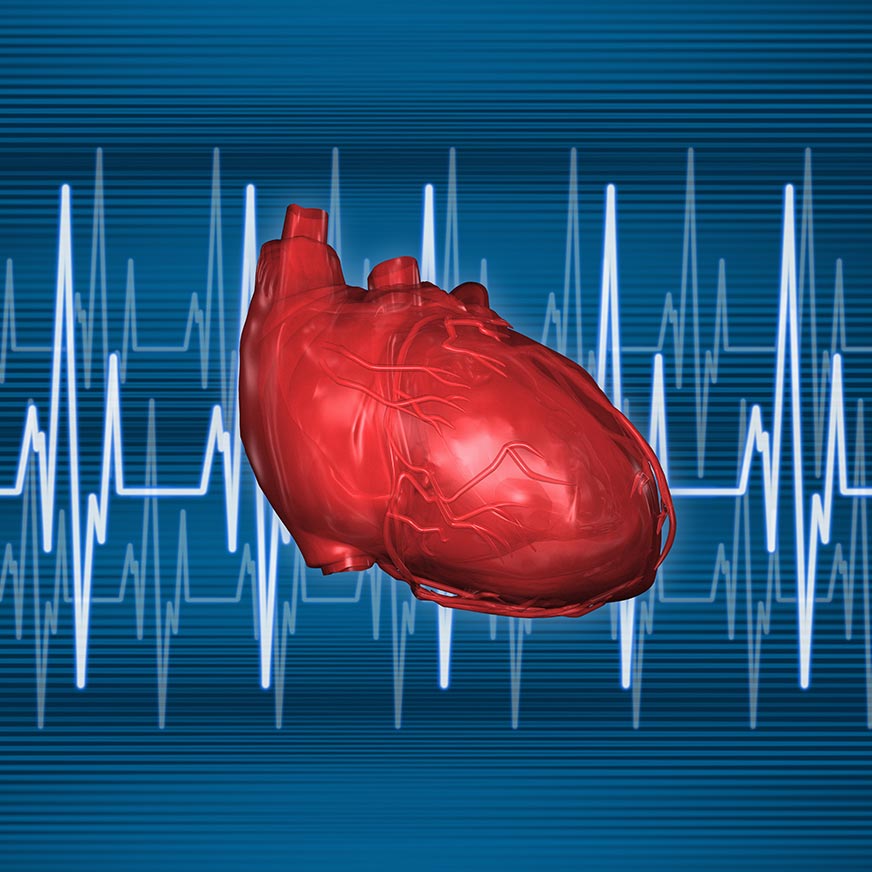 Cardiovascular Research Solutions 