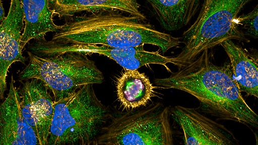 Cell-Based Solutions Cancer Research