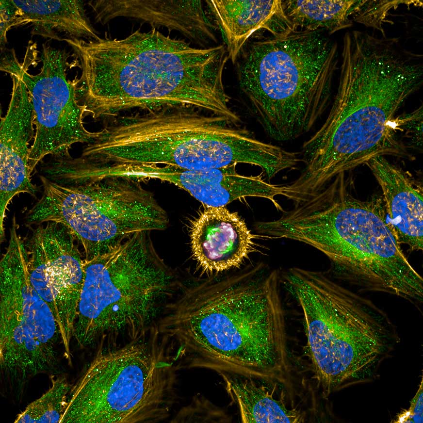 Cell-Based Solutions Cancer Research