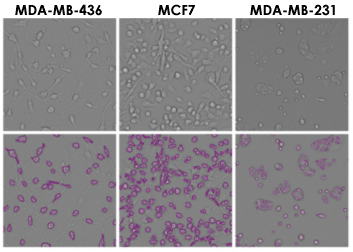 Brightfield imaging of breast cancer cell lines