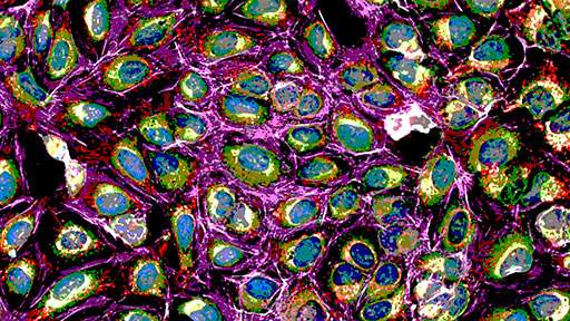 cell-painting-a-cellular-imaging512