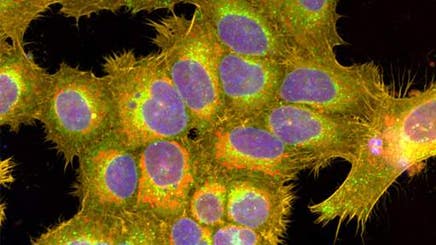 cell-painting-for-pheno512