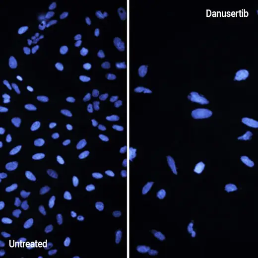 U-2 OS cells treated or untreated and stained with PhenoVue Cell Painting JUMP Kit