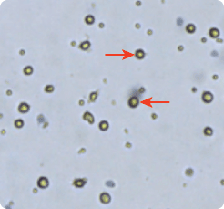 Mature Dendridic Cells