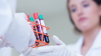 chemagic workflows 512x288