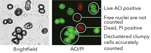 clumpy hepatocytes aopi