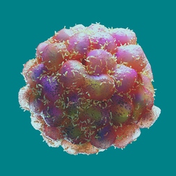 composition-of-the-tumor-stromal-microenvironment