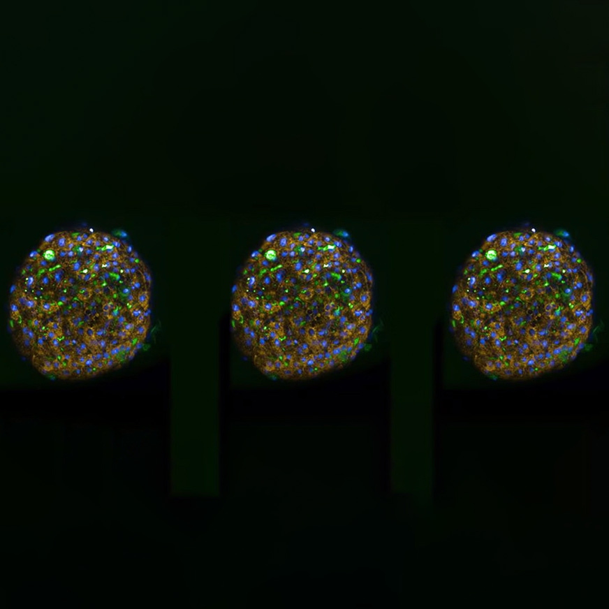 confocal-imaging-872x872