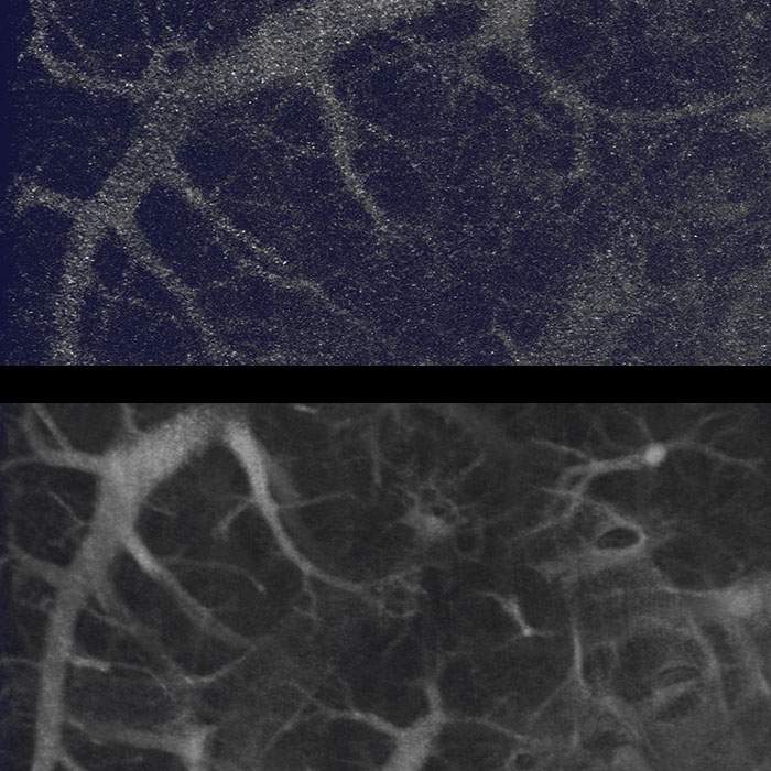 Continuous vs step scanning on Quantum GX3 microCT system