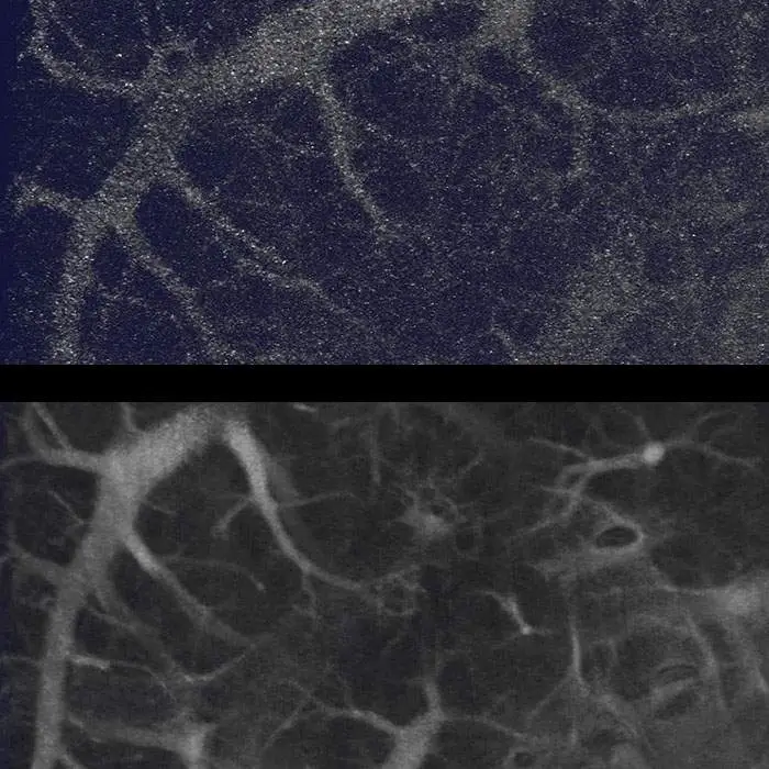 Continuous vs step scanning on Quantum GX3 microCT system