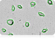 count irregular shaped cell automatically