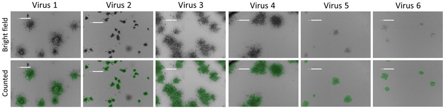 Counting hrp positive infected plaques