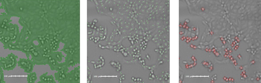 cpe-induced-by-sars-cov2-850x270