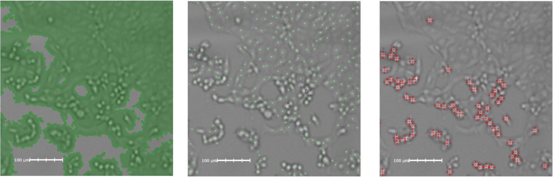 cpe induced by sars cov2 