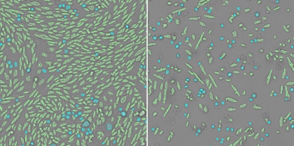 cpe morphological changes 