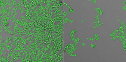 cpe total cell count 