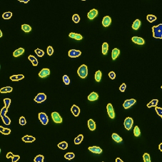 DAPI BdrU mask segmentation