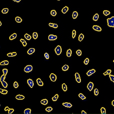 DAPI mask segmentation