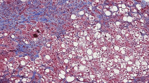 developing-phenotypic512