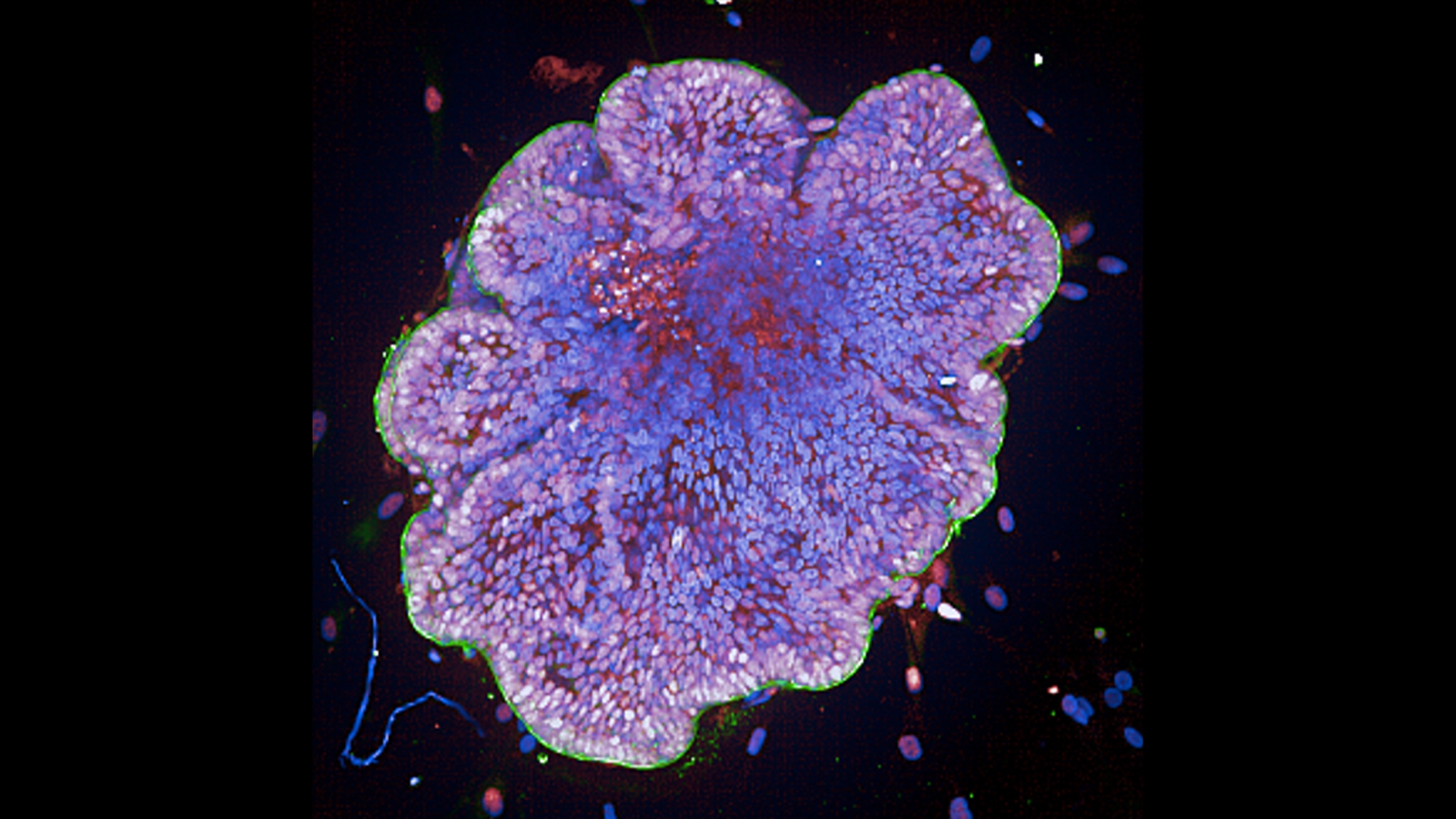 organoid thumbnail