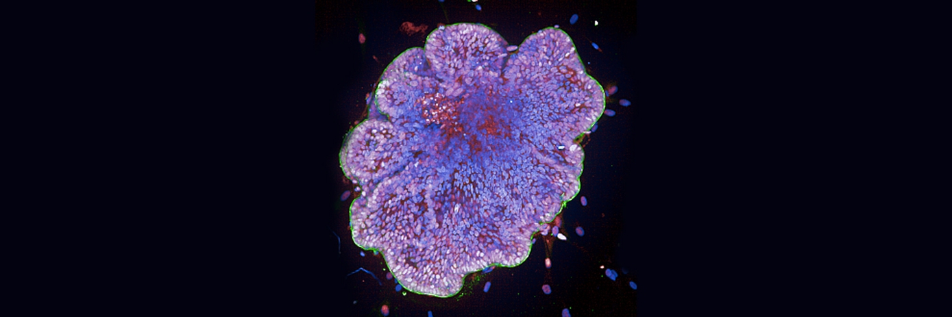 organoid blog hero