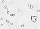 Embryonic Stem Cells