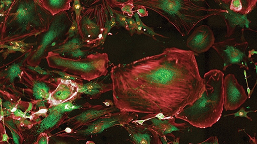 ex vivo functional 512x288