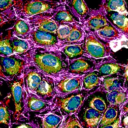 FGS for hcs phenotypic