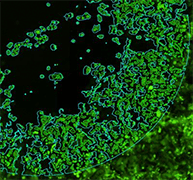 Fluorescent confluence wound healing