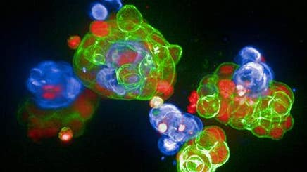 Harness the power of 3D cell model imaging | Revvity