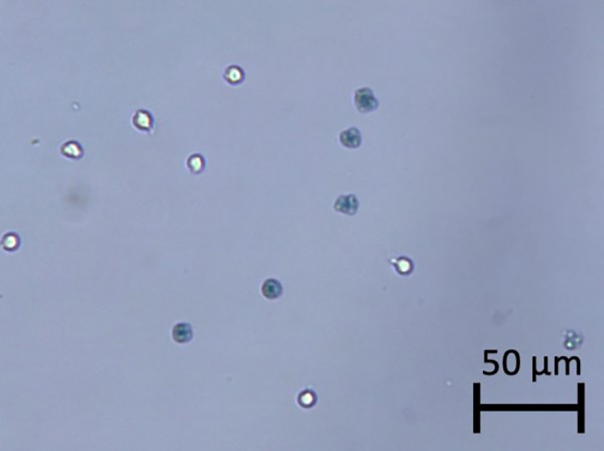 heat-killed-trypan-blue-stained-cells-fig6-850x635