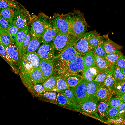 HPAF-II cells