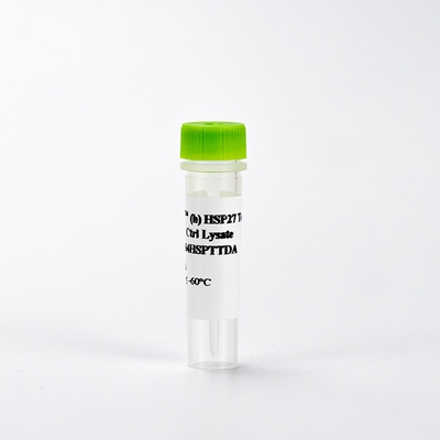 Picture of HTRF HSP27 total control