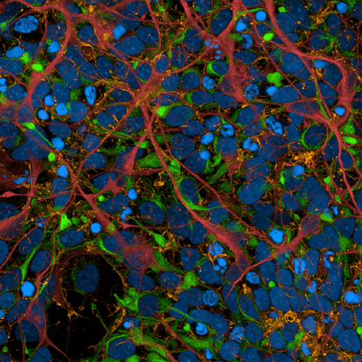 iPSc-derived human cortical neurons stained with PhenoVue neuronal differentiation staining kit, imaged on the Opera Phenix Plus HCS system.