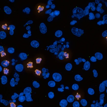 human cells treated with Nocodazole