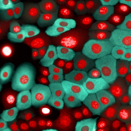 Human mammary epithelial cells