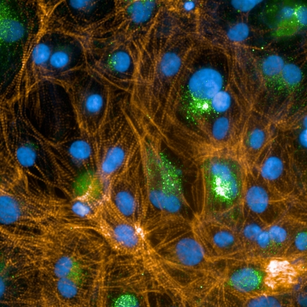 cardiomyocytes