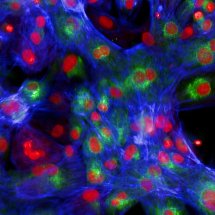 Human cardiomyocytes