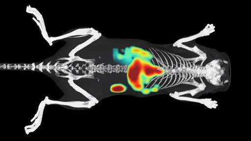 imaging-hepatocellular