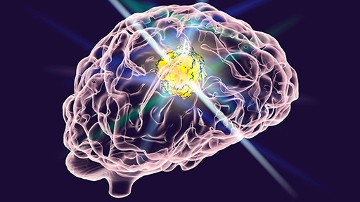 imaging-modalities512