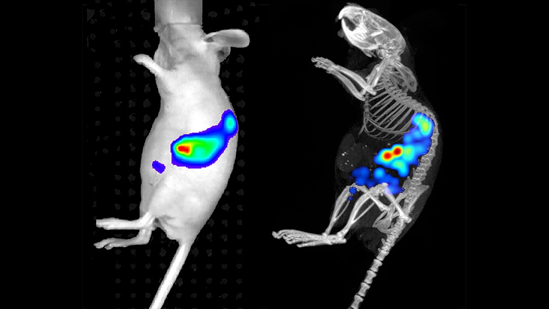 2D and 3D imaging of tumor