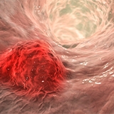 Advancing cancer research through epigenetic profiling