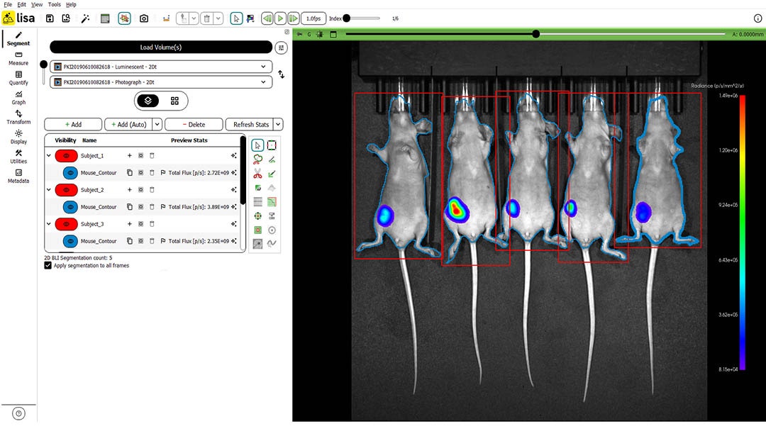 AI-assisted whole-body segmentation